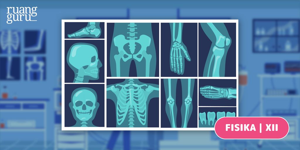 Peran Sinar X dalam Kehidupan